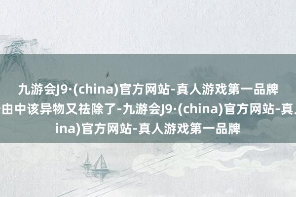 九游会J9·(china)官方网站-真人游戏第一品牌”然后在手术经由中该异物又祛除了-九游会J9·(china)官方网站-真人游戏第一品牌